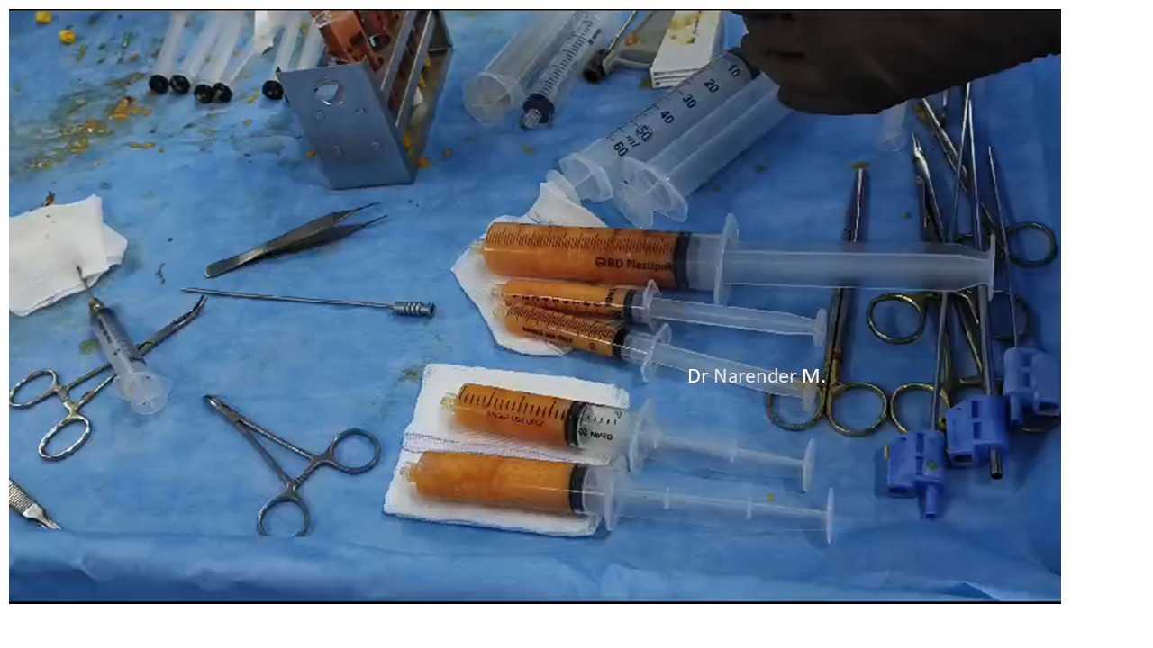 Breast Augmentation Photo 19