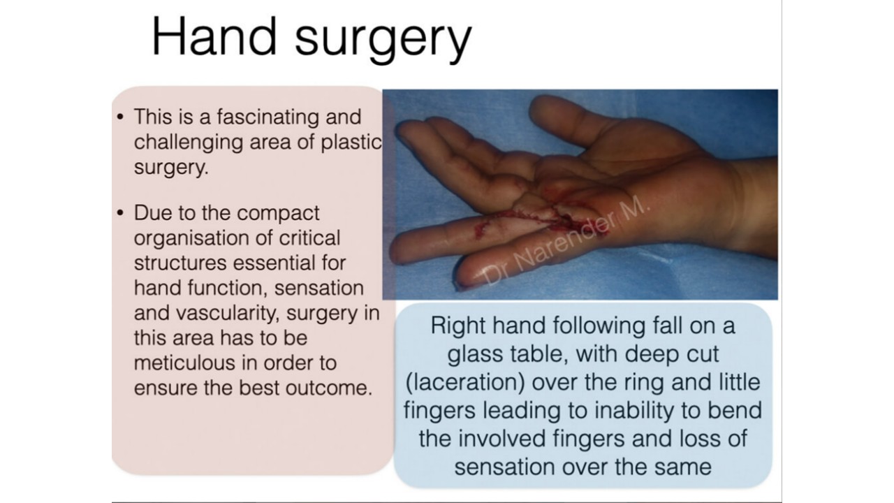 Hand Surgery Photo 4