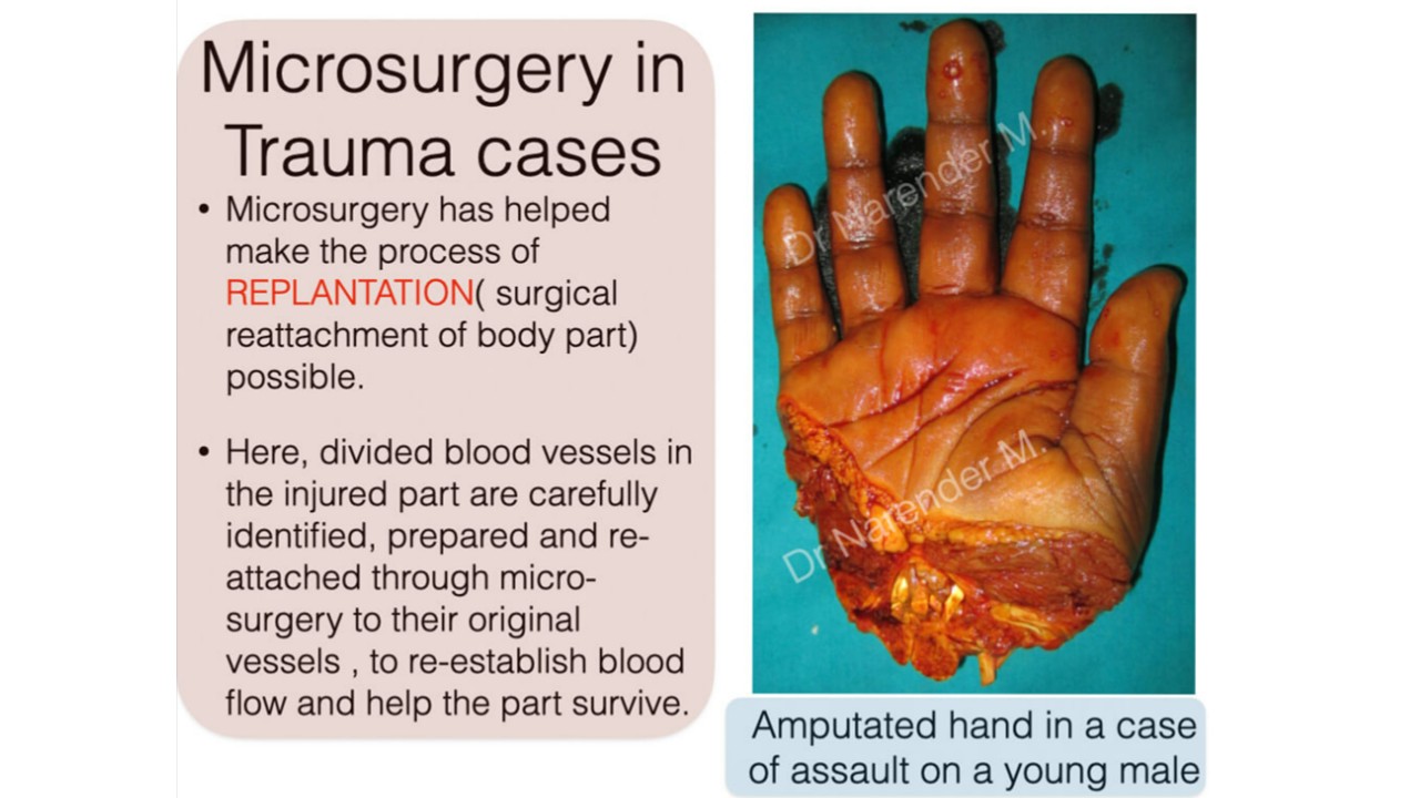 Hand Surgery Photo 7