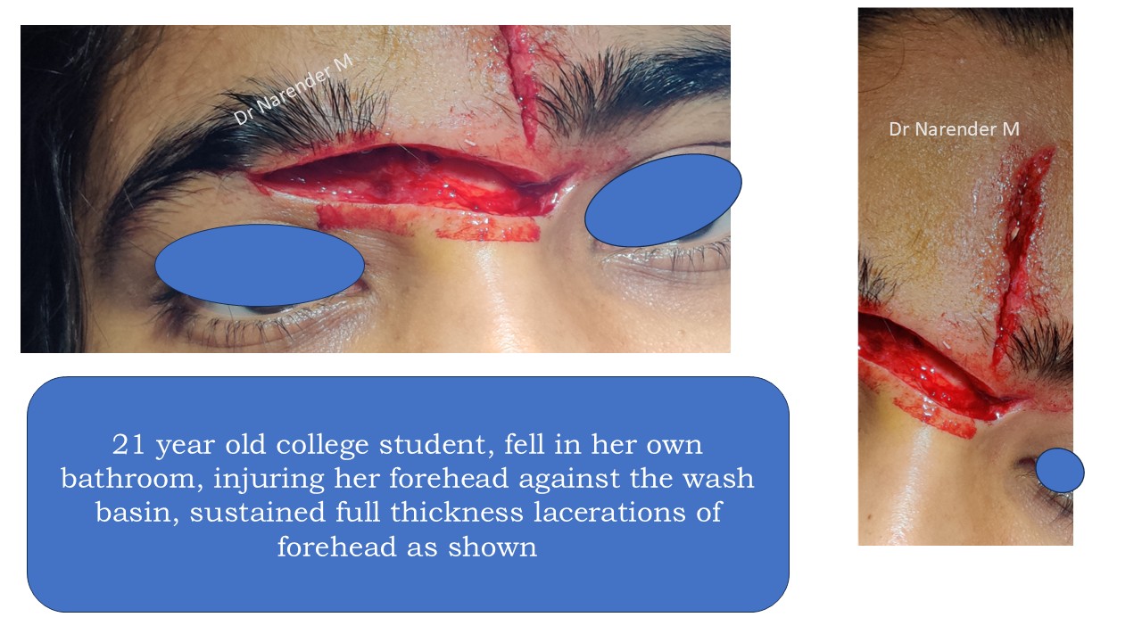 Facial trauma gallery image 1