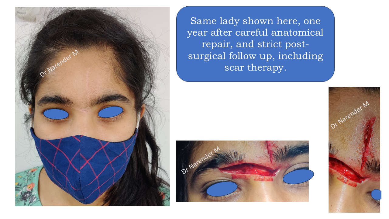 Facial trauma gallery image 2