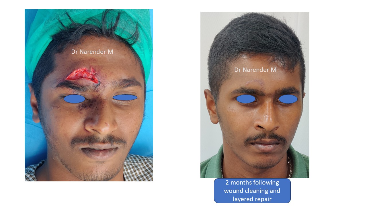 Facial trauma gallery image 3