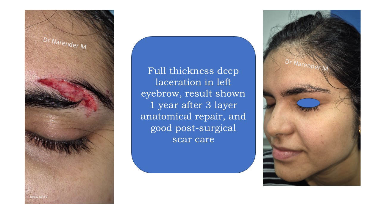Facial trauma gallery image 4