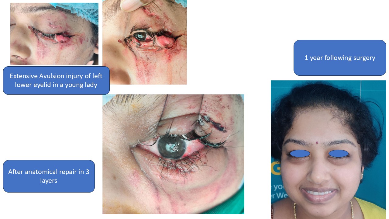 Facial trauma gallery image 5