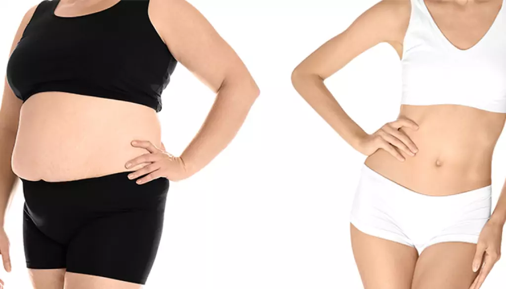 Post Weight Loss Surgeries